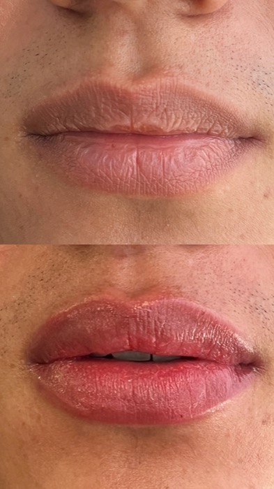 Transformación real de labios