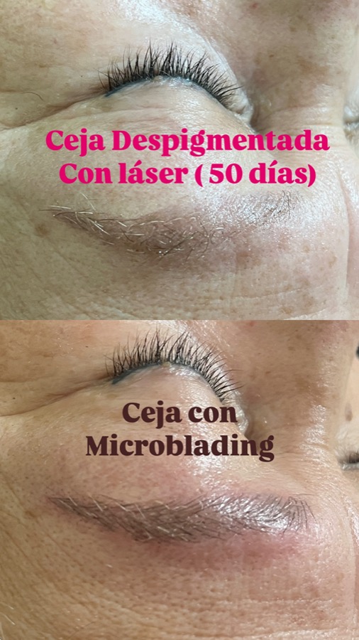 Antes y después de micropigmentación de cejas con microblading